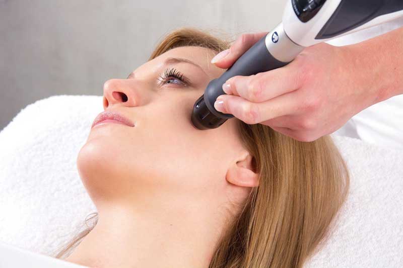 procedimiento del tratamiento de ondas de choque faciales para combatir la flacidez